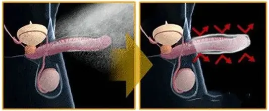 动十几下就忍不住想射怎么办
