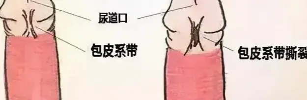 处男线头?丁丁里的小线头,才是神秘开关?